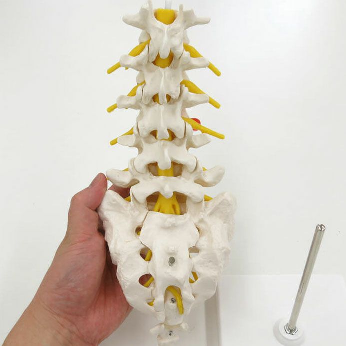 腰椎モデル（ヘルニア付）