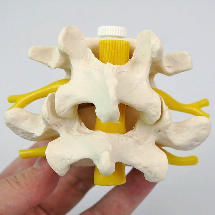 腰椎2交連モデル