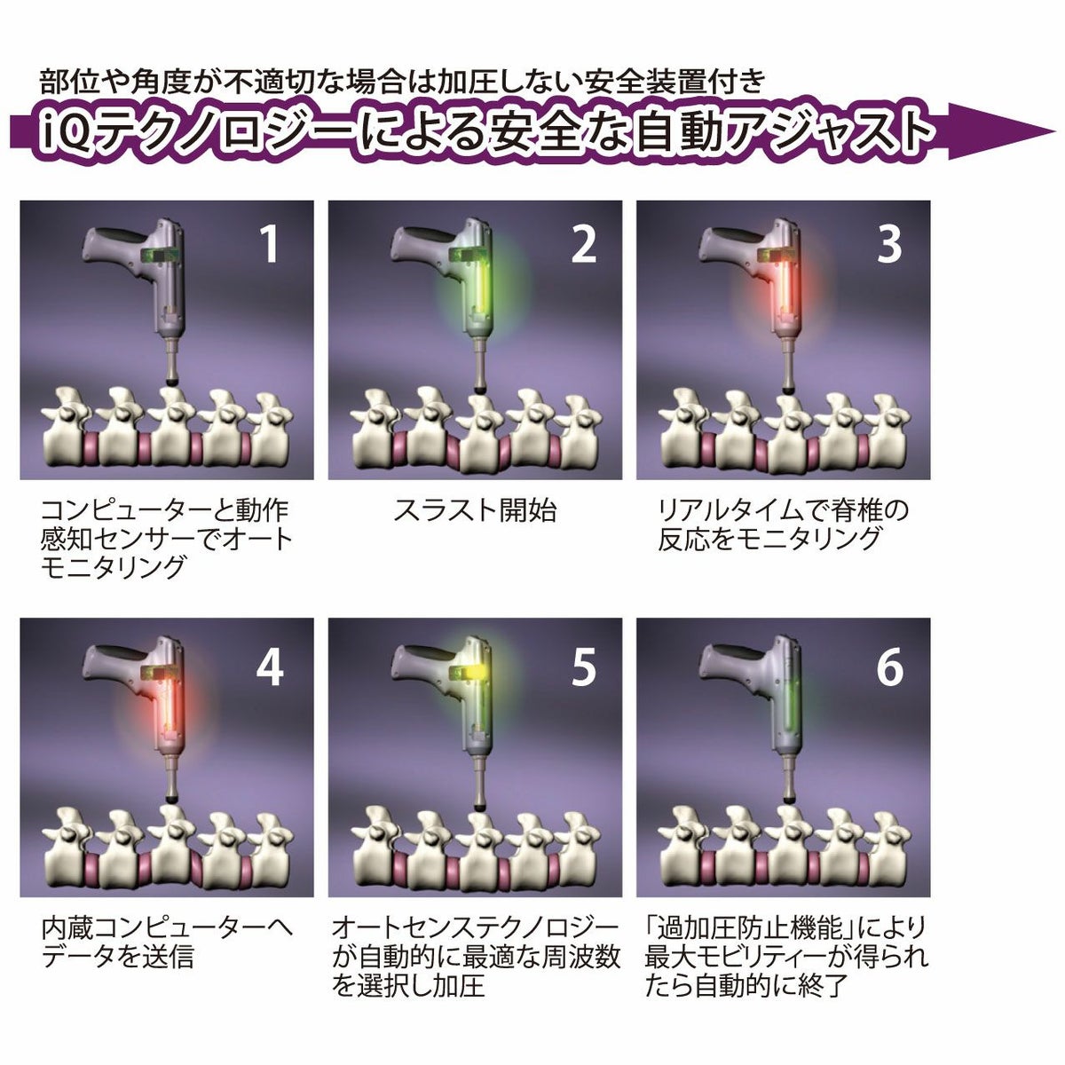 インパルス iQ 解説